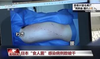 中国有食人菌吗现在 中国有食人菌吗现在